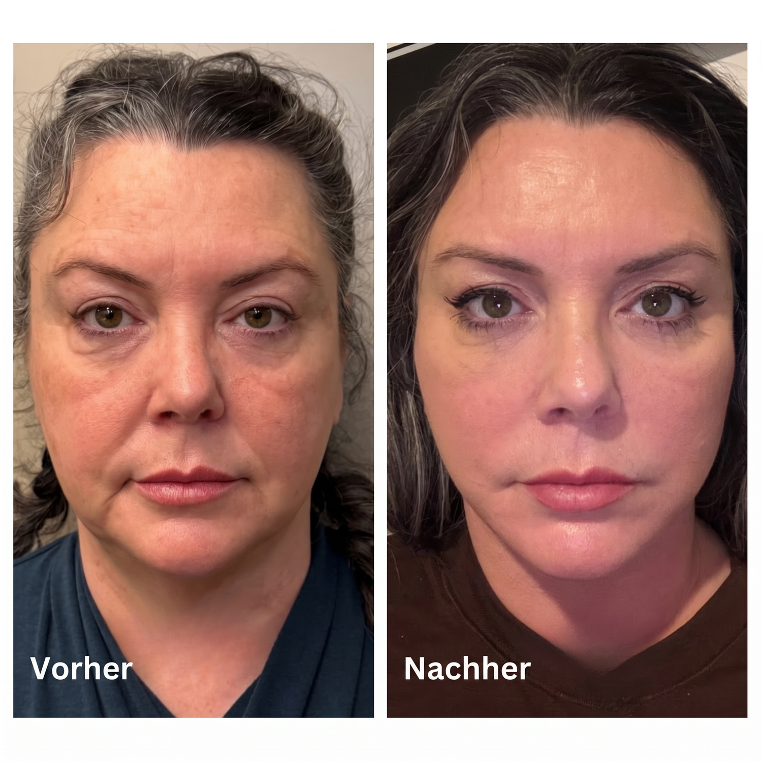 Kalea Gesichtsbürste für lymphatische Modellierung